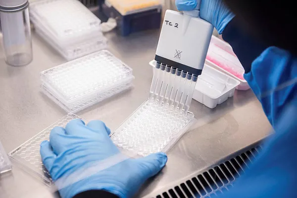 Astrazeneca - Oxford Üniversitesi koronavirüs aşısı hakkında şoke eden itiraf: Hata yaptık-6