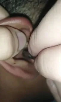 Midesine güvenenler baksın! Kulak ağrısıyla hastaneye giden adamın kulağından çıkanlar dünyayı şoke etti - 2