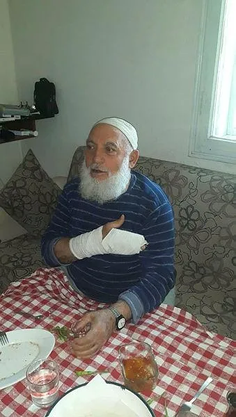 Kurban pazarlığında şoke eden olay! Pazarlık ederken müşterisinin parmaklarını kırdı-1