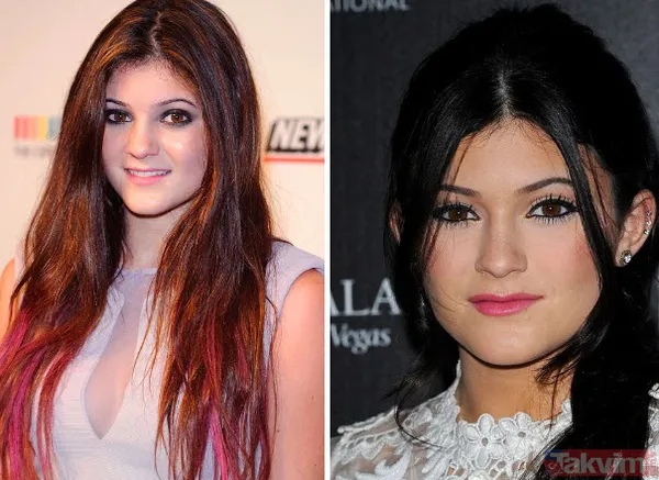 Bella Hadid ve Şeyma Subaşı'nın idolü Hailey Baldwin'in estetik açıklaması olay: Yüzüme asla dokunmadım! - 22