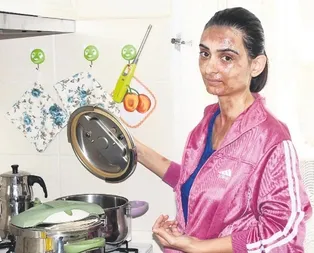 Yüzde ’yüz’ acı!