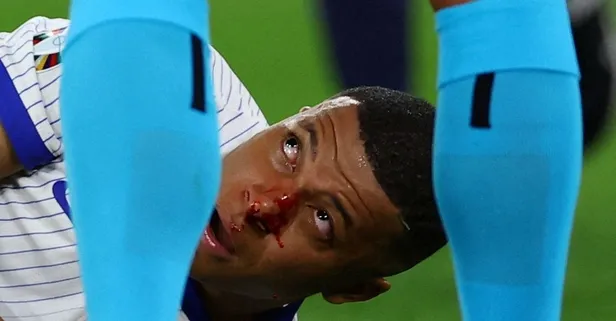 Kylian Mbappe Hollanda maçında oynayacak mı? EURO 2024’e damga vuran sakatlıkta son söz Deschamps’ta! Avusturya maçında burnunu kırmıştı: Maske açıklaması gündem oldu