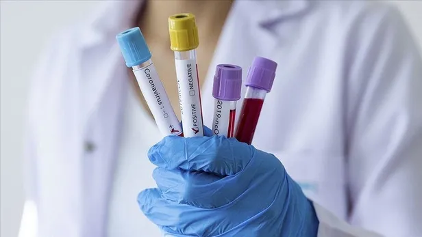 Koronavirüsle mücadelede son 24 saat: 7 bin 533 test yapıldı, 2 bin 69 pozitif vaka tespit edildi-8