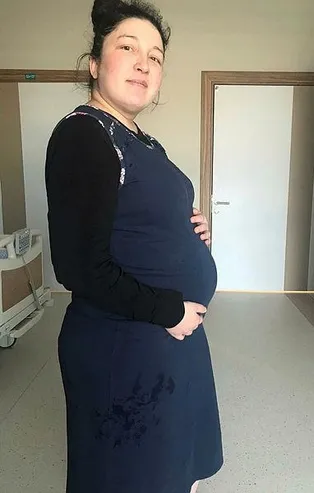 Kadavradan rahim nakli yapılan Derya Sert, anne oldu! Prof Dr. Ömer Özkan müthiş doğumu TAKVİM'e anlattı