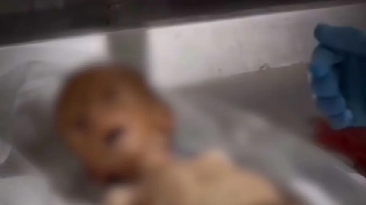 Gazze her dakika yok oluyor! 2,5 aylık bebek açlıktan şehit oldu... İnsanlığın tükendiğini gösteren kare