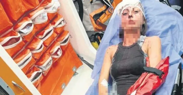 Uzaklaştırma kararına rağmen eşi tarafından darp edildi! "O korkuyla tekrar yüzleştim"