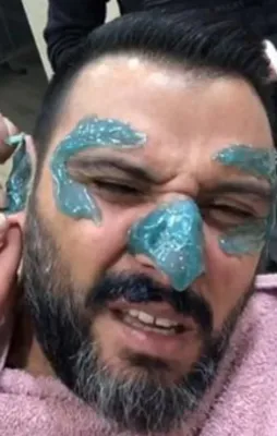 Alişan ağda yaptırdı!