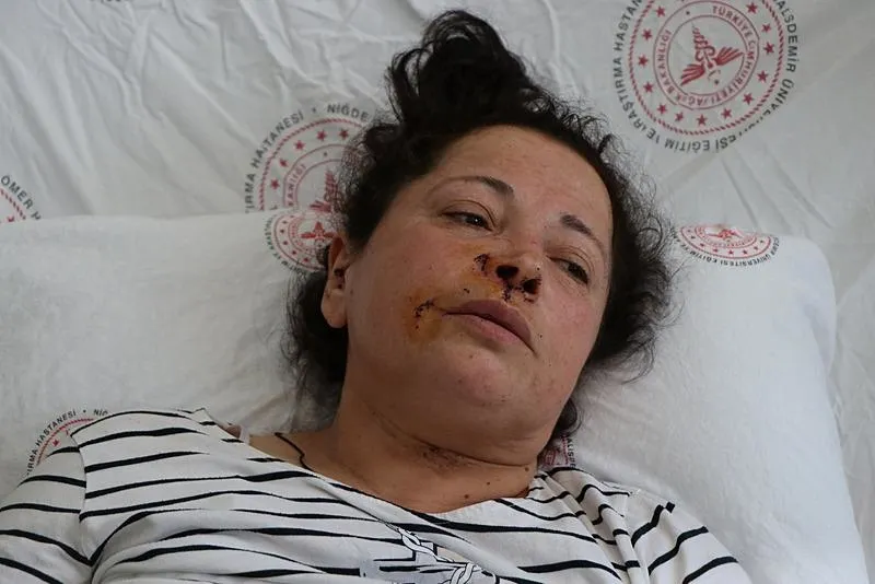 Mama lobisinin medya ayağı sokak köpekleri için ayaklanma çağrısı yapıyor ipini koparan köpekler vatandaşa saldırıyor! | RTÜK Başkanı Şahin'den tepki-8