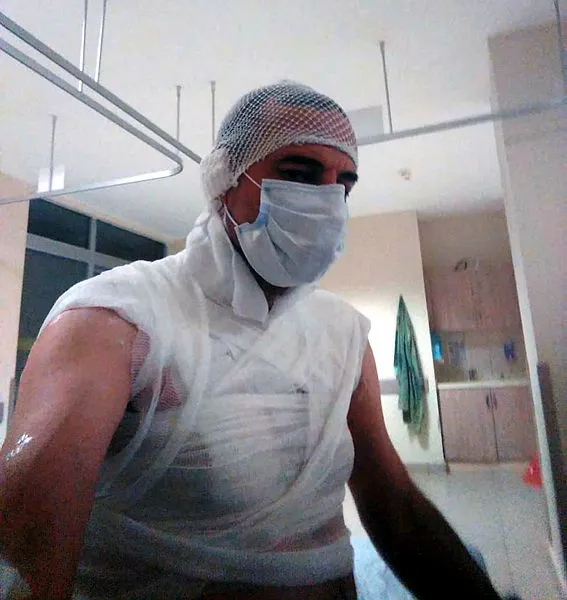 edirnede-dehset-komsusunun-uzerine-kaynar-su-doktu-1619939945944.jpg Edirne'de akıllara durgunluk veren olay: Komşusunu kaynar suyla haşladı!-5