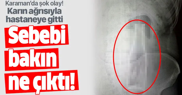 Karın ağrısıyla hastaneye gitti, içinden soda şişesi çıktı! Karaman'da şok olay