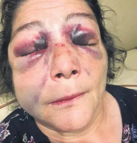 Giresun Eynesil İlçesi'nde bakımsız parkın yenilenmesini isteyen vatandaş darp edildi-1