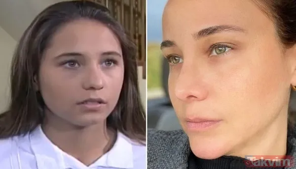 Esra Bilgiç estetik harikası çıktı! Eski halini görenin gözleri fal taşı gibi açıldı: Doğal sanıyordum! Diriliş Ertuğrul’un yıldızı... - 8