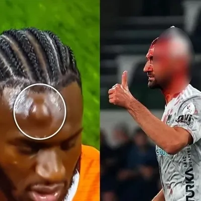 Başakşehir - Kocaelispor maçında talihsiz an!