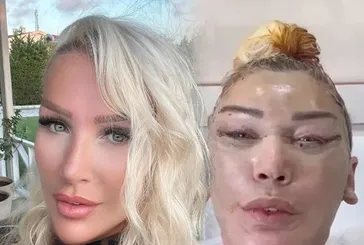 Seda Sayan’ın ablası da tüm yüz estetik operasyon geçirmişti! Son hali şoke etti