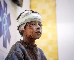 Doğu Guta’da insanlık dramı