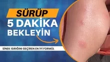 Sinek sokmasına en iyi formül! 50 ısırık bile olsa hissetmeyeceksiniz! Sürün ve 30 saniye bekleyin