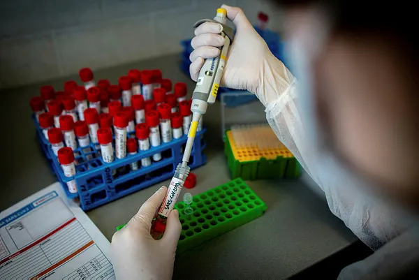 Şoke olacaksınız! Koronavirüsün bir etkisi daha ortaya çıktı! Hastalık geçirenlerin yüzde 88'i...-4