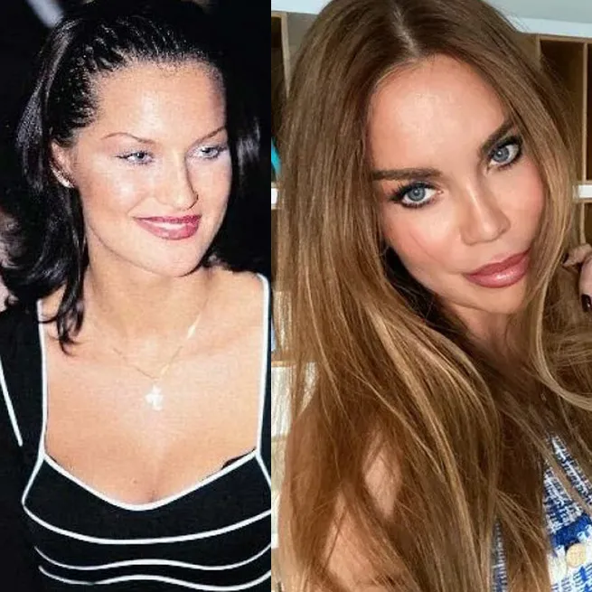 Yüz lifting yaptıran Ebru Yaşar’ın son hali olay oldu: İnsan bunu kendine nasıl yapar? - 18