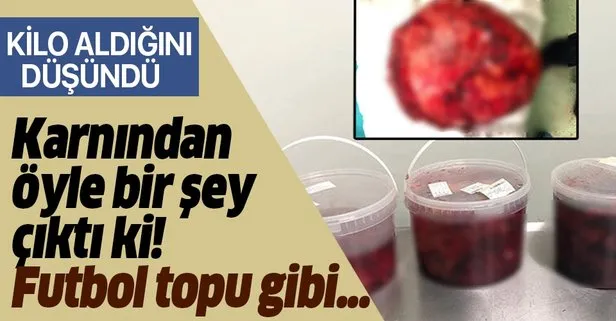 Kilo aldığını sayoyordu ama karnından futbol topu büyüklüğünde ur çıktı