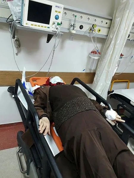 aydinda-sokak-kopeklerinin-saldirisina-ugrayan-yasli-kadin-hastanelik-oldu-1642282617823.jpeg Aydın'da sokak köpeklerinin saldırısına uğrayan yaşlı kadın hastanelik oldu!-1