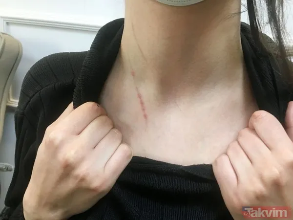 Kadınlardan kadınlara korkunç taciz ve işkence! Mağdur sayısı artıyor! "Yüzümde sigara söndürdüler" - 9