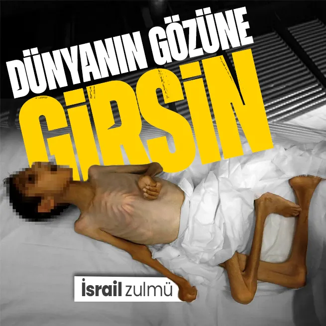 İsrail 13 yaşındaki Abdulkadir es-Serhiyi açlıktan öldürdü!