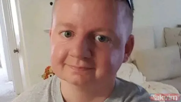 Yüzü 10 Aylık Bir Bebeğin Yüzü Gibi Görünüyor Ama 30 Yaşında.