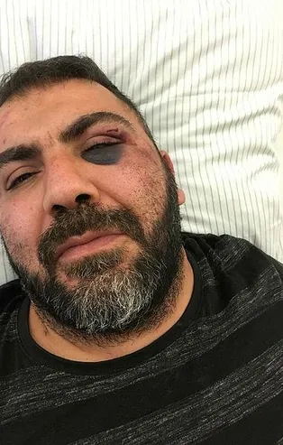 Almanya'da ırkçı saldırı