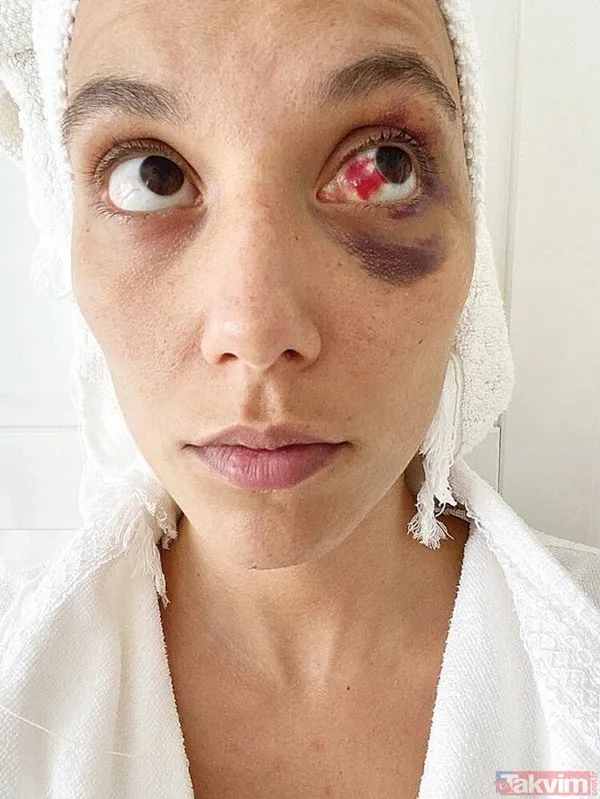 İstanbul Aile Mahkemesi'ne Sunulan İtiraz Dilekçesinde İddiaların Tümünün Gerçeğe Aykırı Olduğu, Asıl Şiddete Maruz Kalan Tarafın Ozan Güven Olduğu Öne Sürüldü.