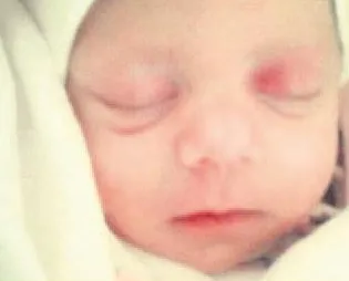 Tatlıya ’Bağ’landı