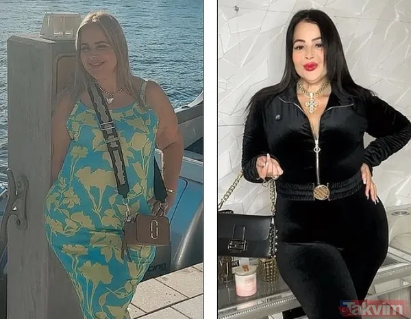 Midesi Kalbinin Arkasına Sıkıştı: Zayıflama Ameliyatı Hayatını Cehenneme Çevirdi - 5