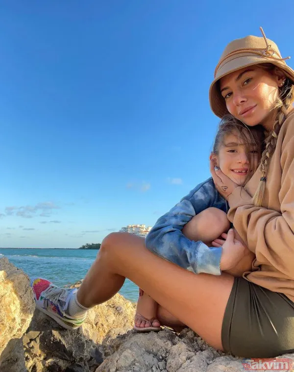 Acun Ilıcalı'nın yüzü gözü morluk içinde gören darp edildi sanıyor ama işin aslı başka! Estetik mi derken... - 26