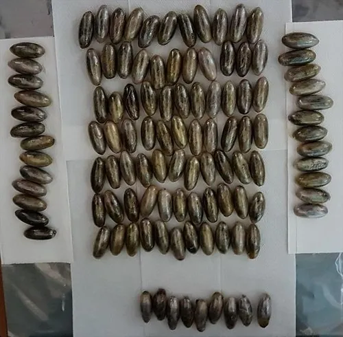 Midesinden 102 kapsül esrar çıktı-2
