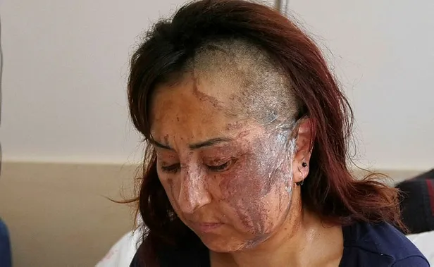 Isparta'da cani adam kendisinden boşanmak isteyen eşine kezzapla saldırdı!-3