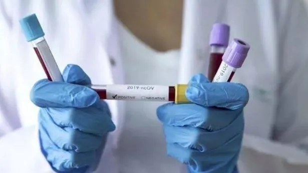 Son dakika: Kovid-19 aşısıyla ilgili flaş açıklama: Gönüllü denemelere başlıyoruz-5