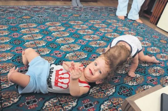 Türkiye her derde derman! Siyam ikizleri Derman ve Yiğit Külliye’de ağırlandı-1