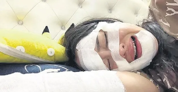 Eğlence amaçlı kullandığı hidrojen balonu kabusu oldu!