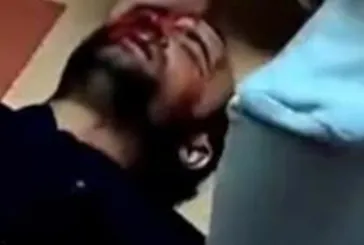 Gaziantep’te kan donduran olay! Sağlık personeli Mustafa Yıldız’ı 16 yerinden bıçakladı! Olayın perde arkasından yasak aşk çıktı!