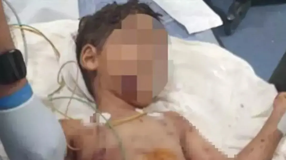 Adana'da 5 yaşındaki çocuk başıboş köpeklerin saldırısına uğradı! Durumu ağır