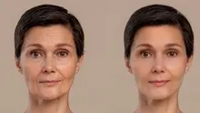 Her gün 6 kolay adımla biyolojik yaşını 10 yıl geri aldı! Gençleşmek için servet harcamaya gerek yok