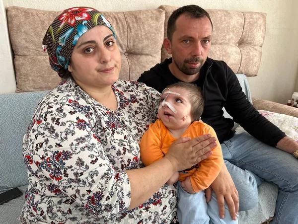 her-25-bin-bebekten-birinde-gorulen-goldenhar-sendromu-ile-dunyaya-geldi-annesi-dili-ve-cenesinden-ameliyat-ol-1651050650781.jpg Her 25 bin bebekten birinde görülen 'Goldenhar Sendromu' ile dünyaya geldi! Annesi dili ve çenesinden ameliyat olmasını istiyor-6