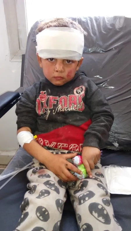 MSB açıkladı: PKK/YPG saldırısında 3 sivil yaşamını yitirdi-2