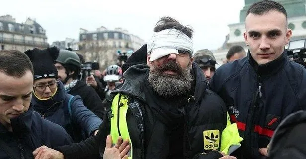 Fransa’da polis Flash-Ball mermisi kullandı 100 kişi gözünü kaybetti!