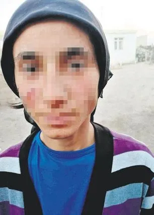 Ağrı'da cani koca dehşet saçtı! Eşinin ve kızının yüzünü yaktı...-1