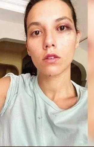 Sevgilisi Deniz Bulutsuz'u döven Ozan Güven'den skandal savunma: Asıl ben şiddete uğradım