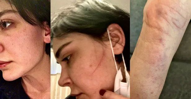 Sermiyan Midyat tarafından darbedilen Sevcan Yaşar o ses kaydını ortaya döktü! 'Çıplak görüntülerimi çekti' demişti...-3