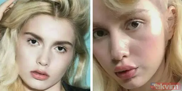 Aleyna Tilki’nin şiş dudakları olay oldu! Son halini gören dönüp bir daha baktı “Ajda Pekkan olma yolunda” - 31