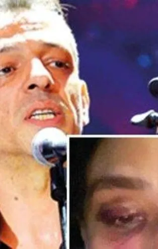 Rubato'nun solisti Özer Arkun da dayakçı çıktı! Kanları silerken çekilmiş görüntüleri foyasını ortaya çıkardı