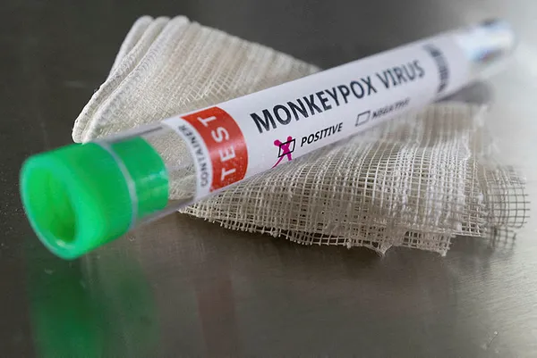 son-dakika-bakan-kocadan-flas-maymun-cicegi-aciklamasi-turkiyede-ilk-vaka-1656571692080.jpg SON DAKİKA! Bakan Koca'dan flaş maymun çiçeği açıklaması! Türkiye'de ilk vaka! Maymun çiçeği hangi ilde görüldü?-11