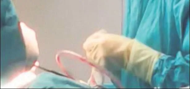 Ameliyatta büyük temizlik